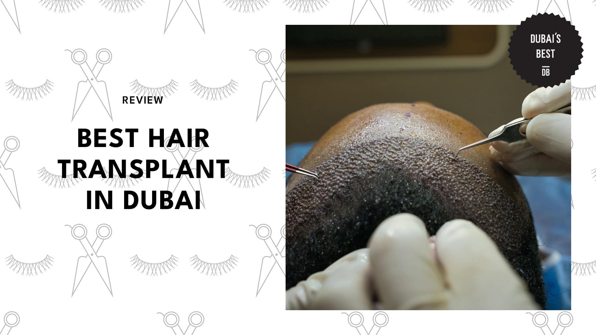 Best Hair Transplant