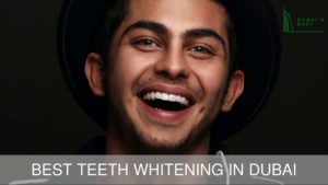 Best Teeth Whitening in Dubai
