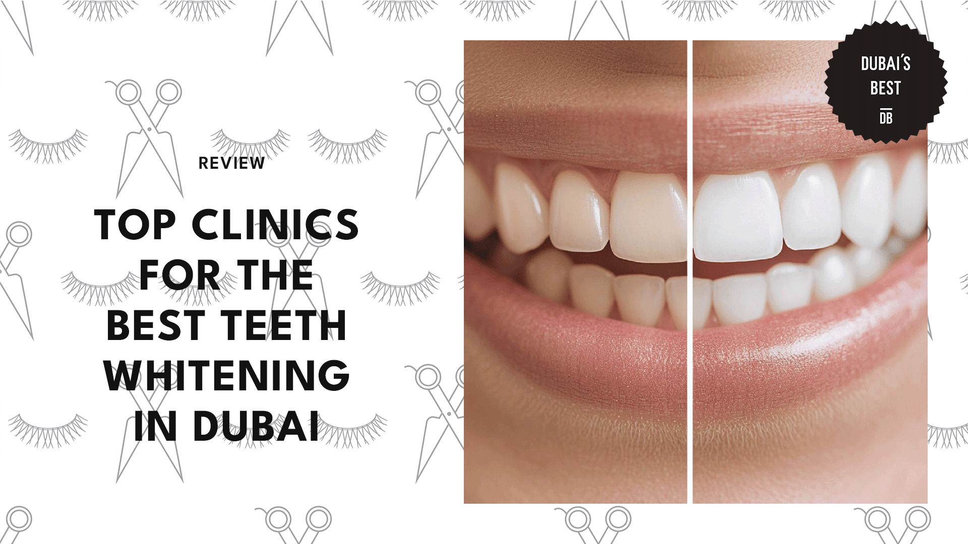 teeth-whitening-in-dubai