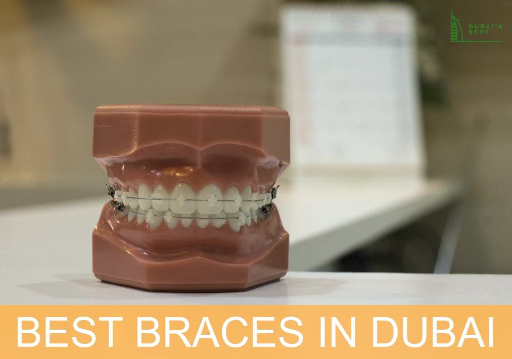 Best Braces in Dubai