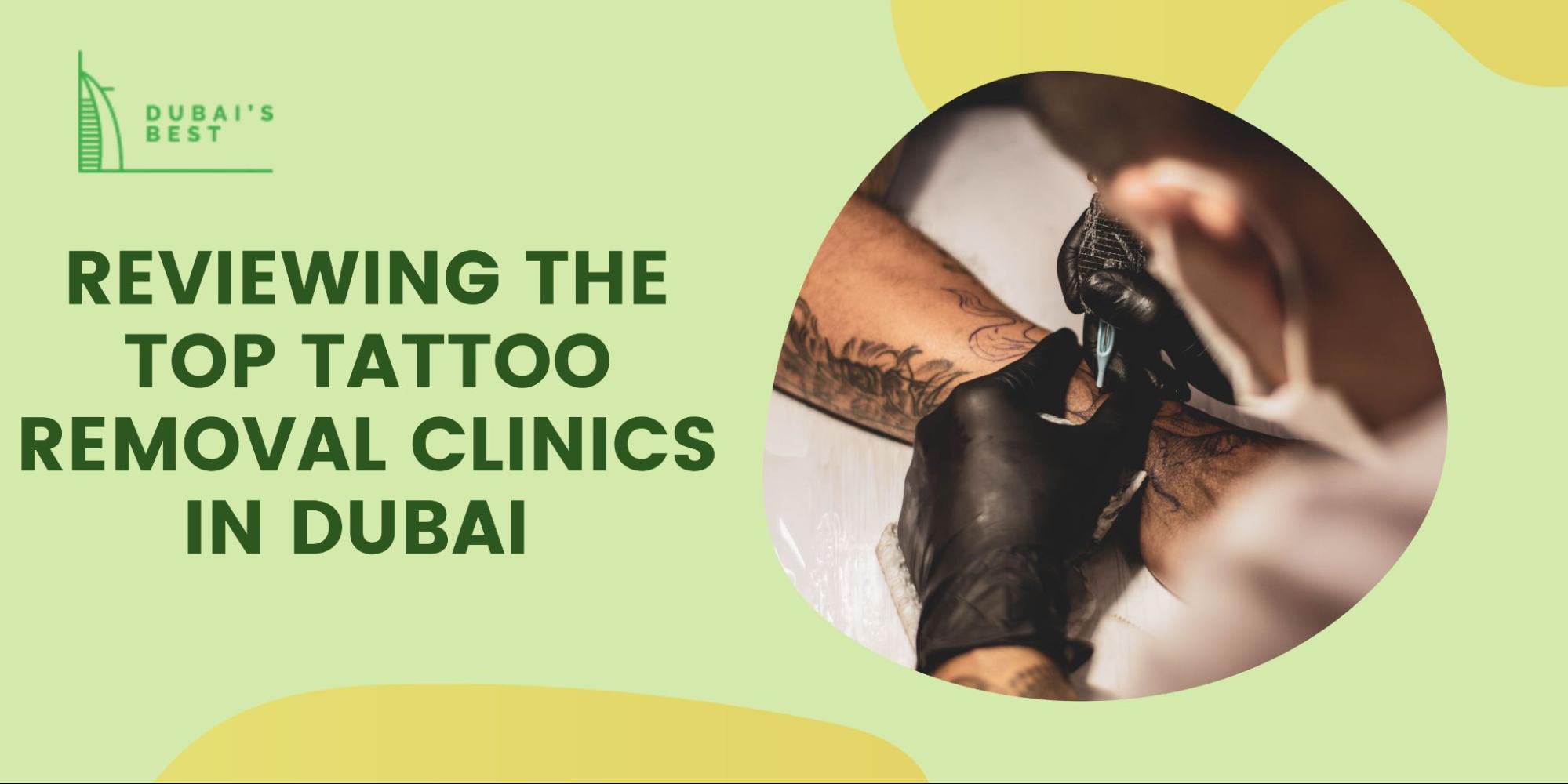5 Best Tattoo Removal Clinics in Dubai [2023 ]