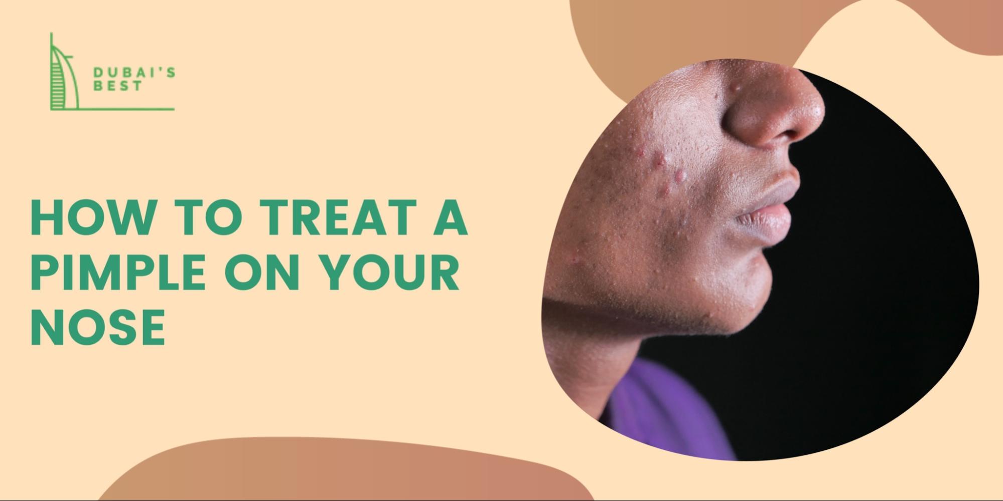 How To Treat A Pimple On Your Nose