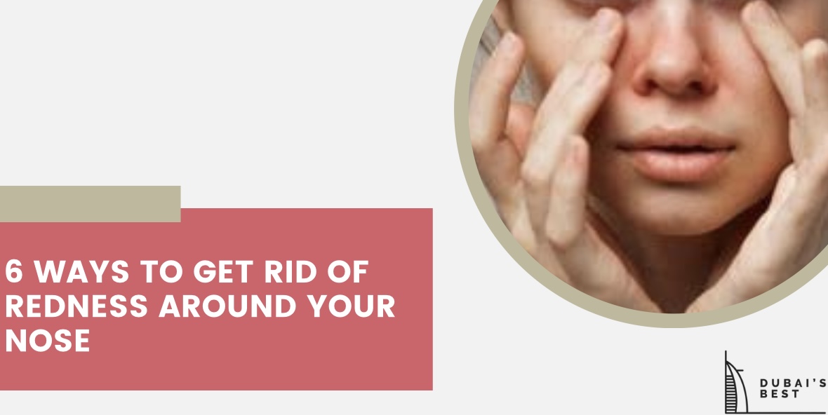 6 Ways to Get Rid of Redness around Your Nose