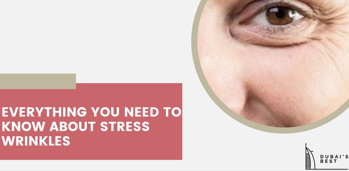 Everything You Need to Know About Stress Wrinkles