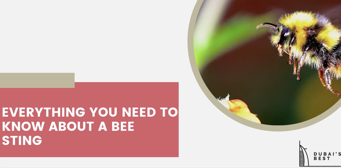 Everything You Need to Know About a Bee Sting