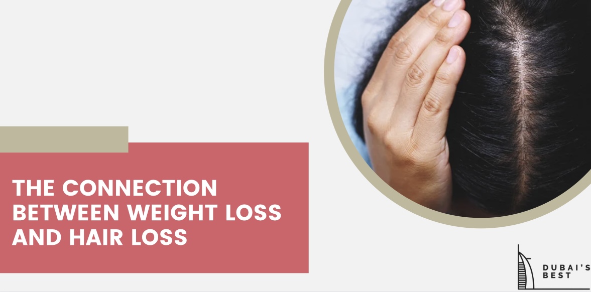 The Connection between Weight Loss and Hair Loss