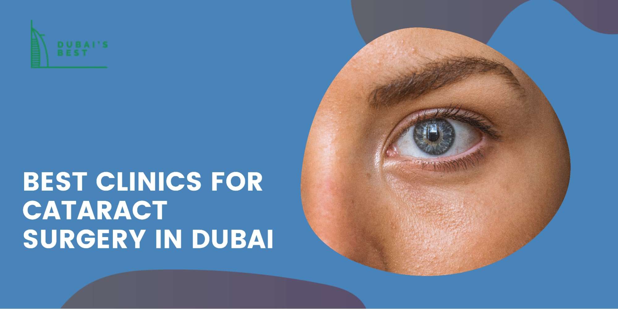 The 5 Best Clinics for Cataract Surgery in Dubai