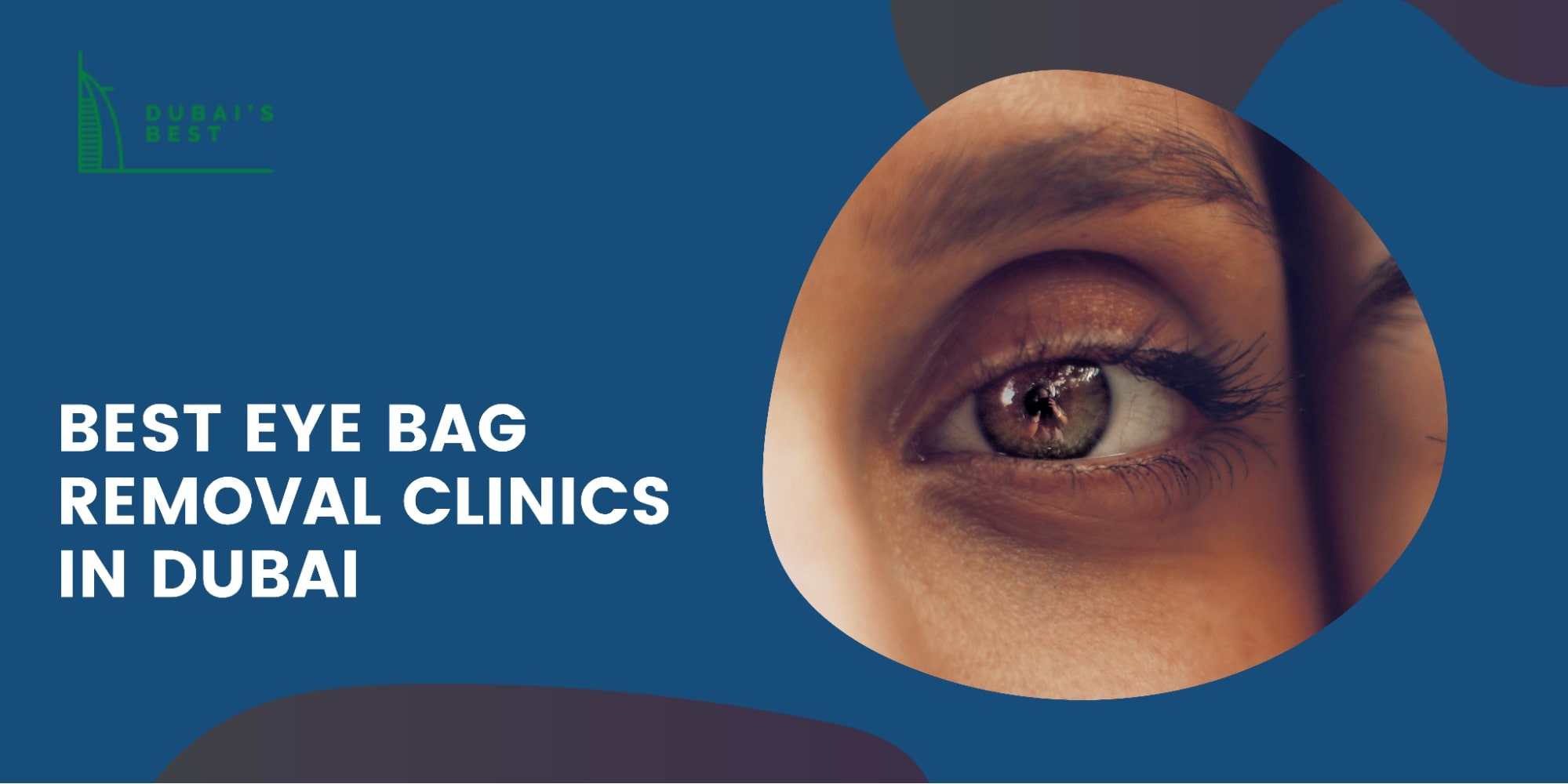 5 Best Eye Bag Removal Clinics in Dubai