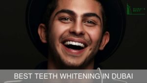 Teeth Whitening